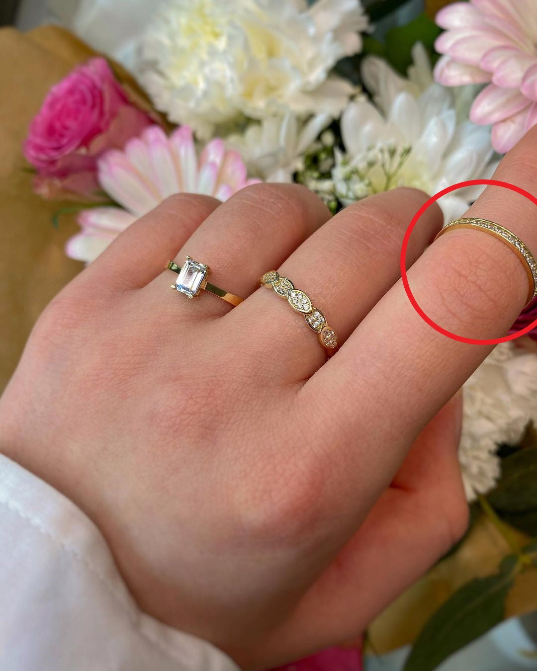 Gelbgoldringe in ver. Varianten